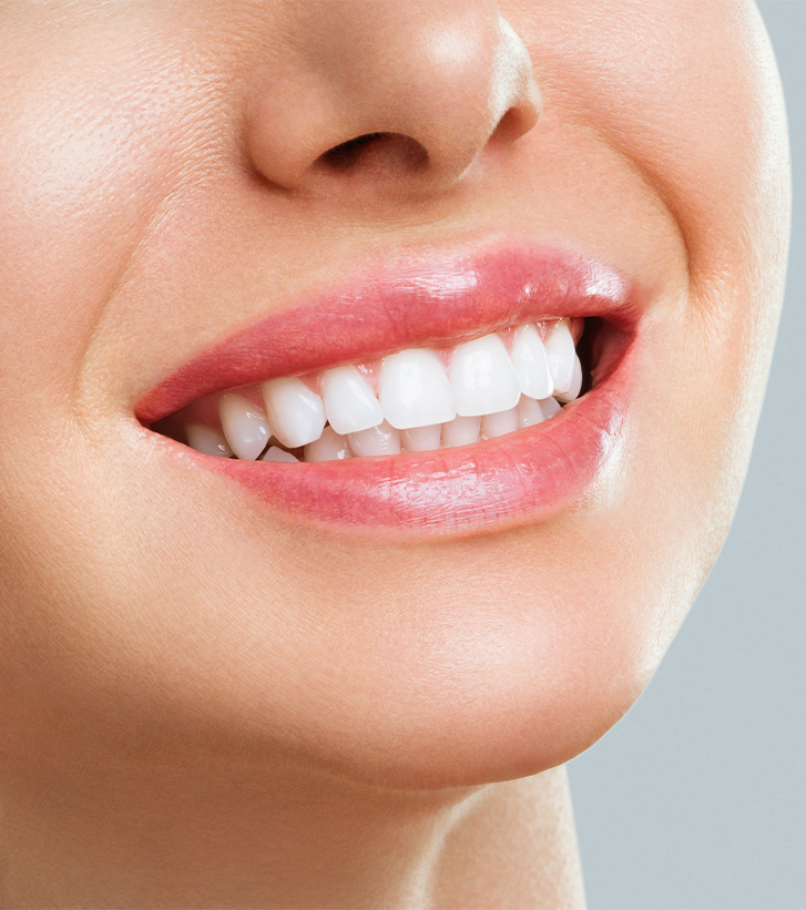 Nose-to-neck ¾ profile view of woman smiling with bright teeth